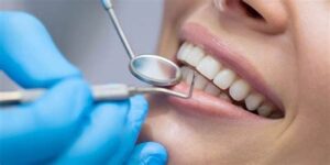 Molar Tooth Decay