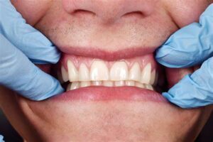 What do healthy gums look like