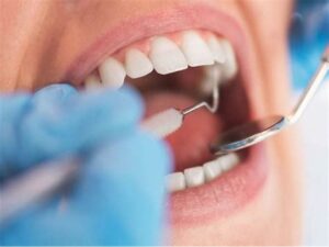 What do healthy gums look like