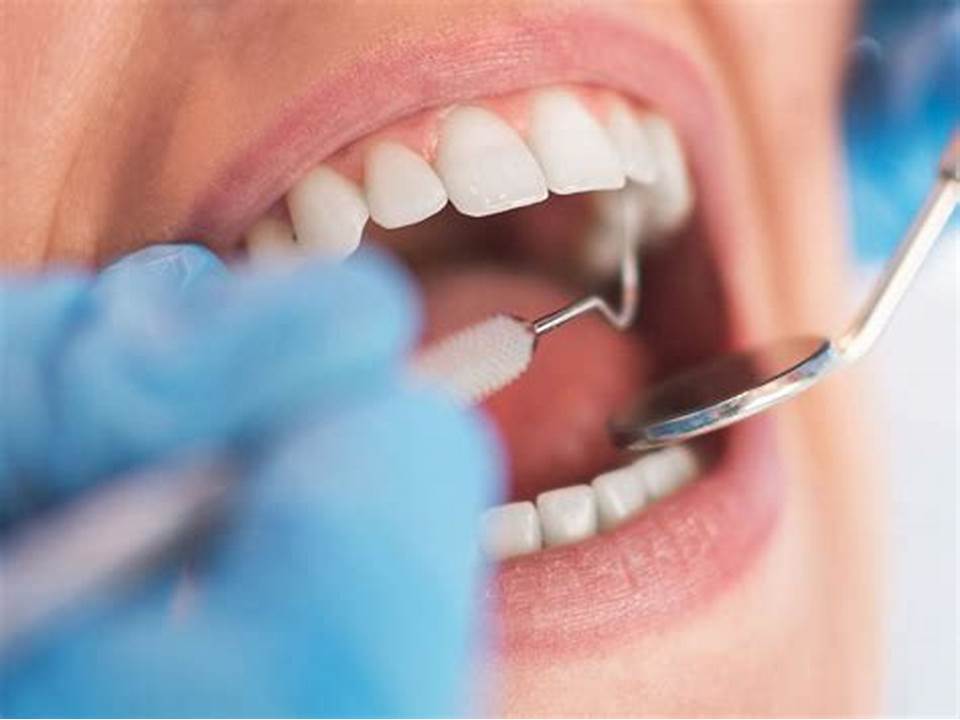 What do healthy gums look like